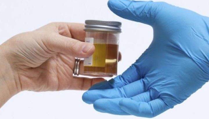 Synthetic Urine Kit How To Use Cherokee Mobile Home Estates Acworth GA